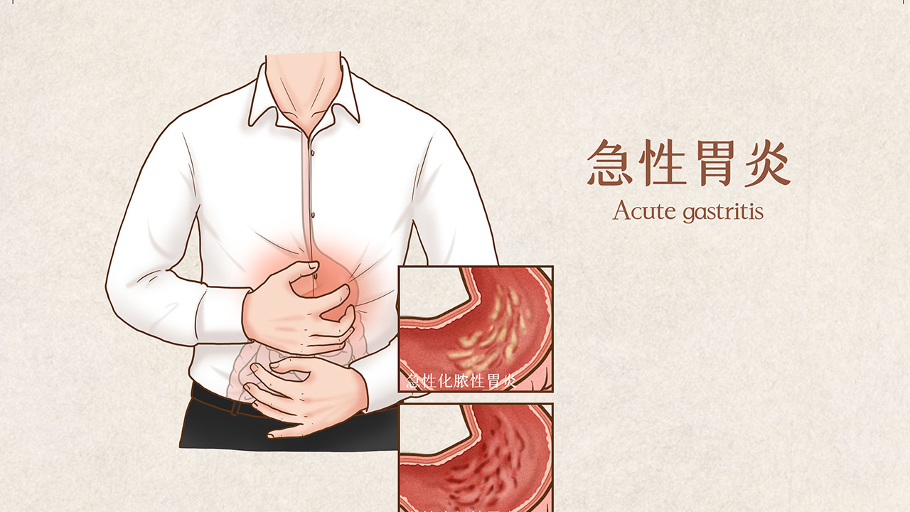 中国人喝热水胃病多,国外常年喝冰水不会得胃病吗