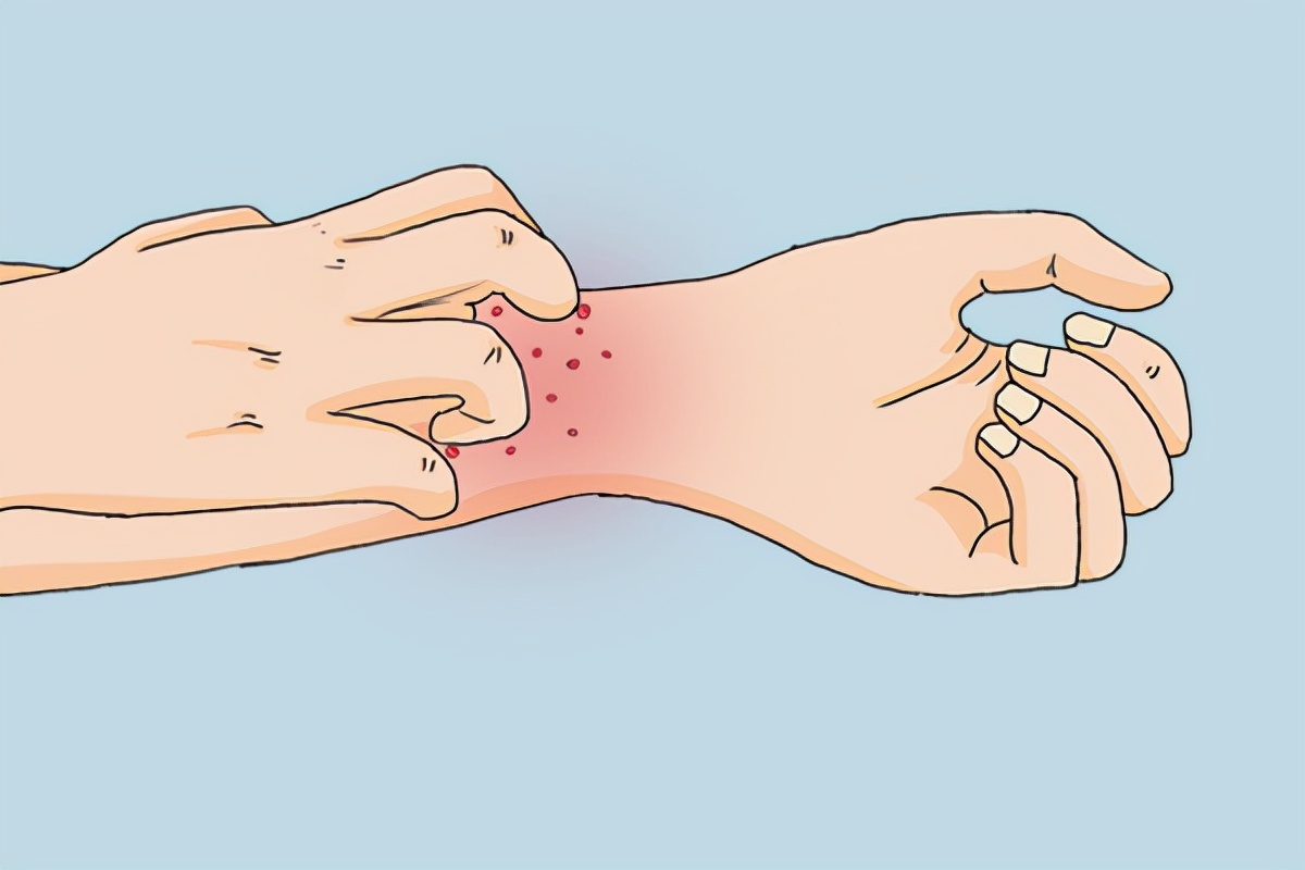 冬天皮肤干燥瘙痒怎么办用什么药,小孩冬天皮肤干燥瘙痒是什么原因