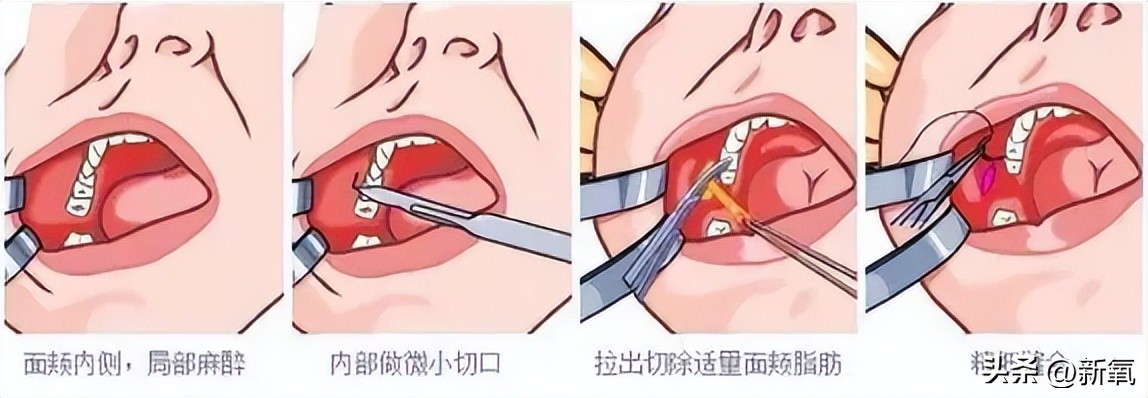 刘雯高级感,刘雯的脸型适合的风格