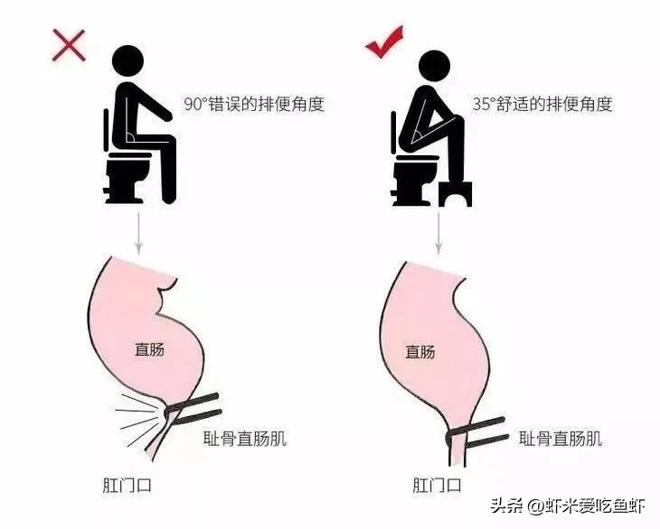 孕期拉不出尿怎么办,孕期肚子胀拉不出