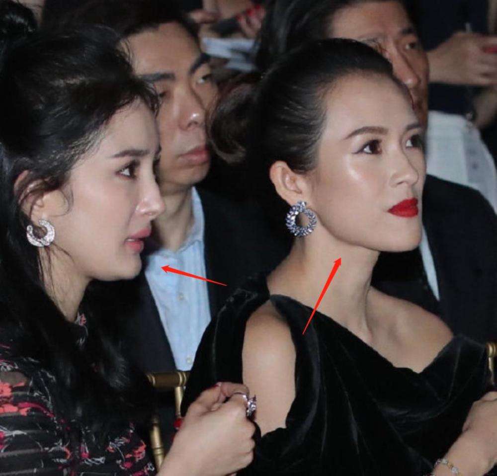 哪些明星整容后遗症越来越严重,整容明星后遗症对比图片