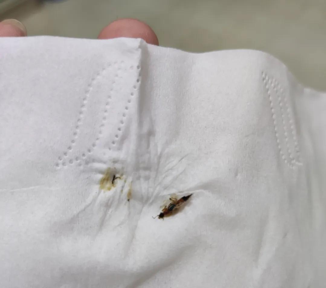 被隐翅虫毁容会好吗,隐翅虫脸上毁容