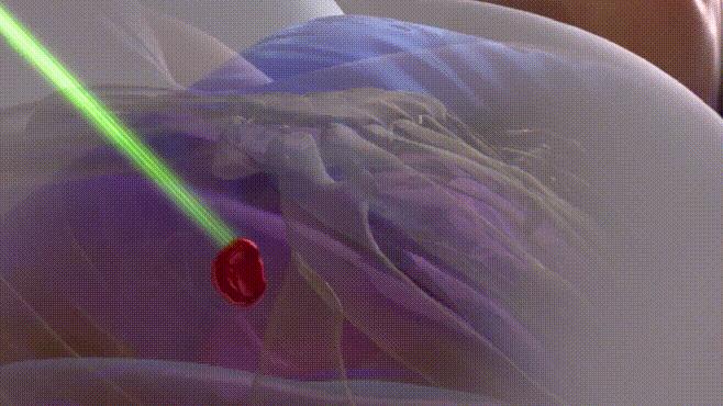 治癌利器是真的吗,治疗癌症新利器