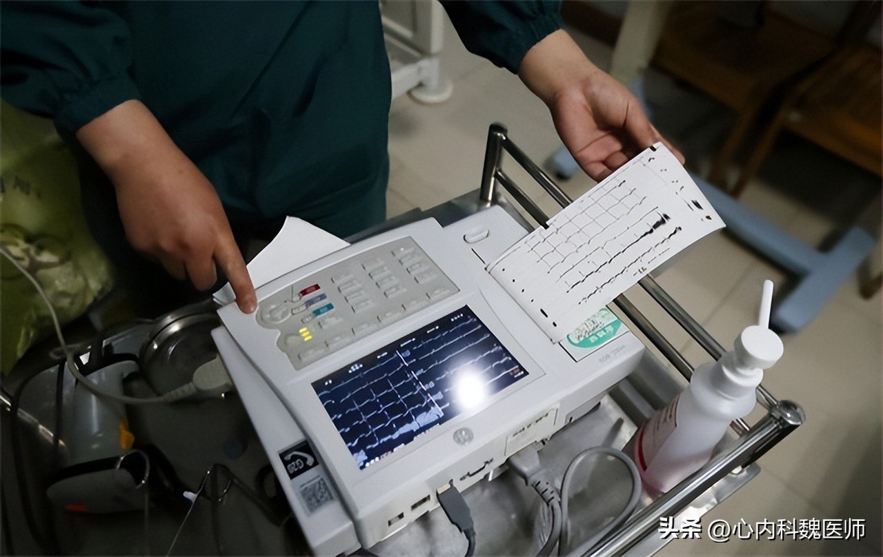 体检窦性心律正常心电图啥意思,体检报告显示窦性心律是什么意思