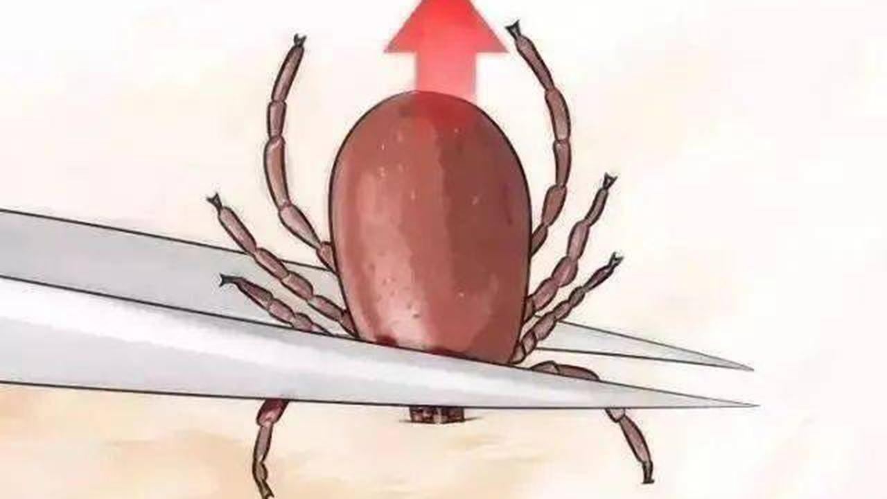 男子被蜘蛛咬了一口居然没事,男子被蜘蛛咬伤后进icu