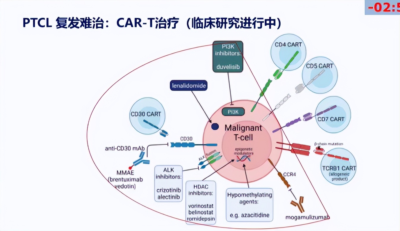 白鸥教授：外周T细胞淋巴瘤的最新治疗进展丨中国肿瘤内科大会