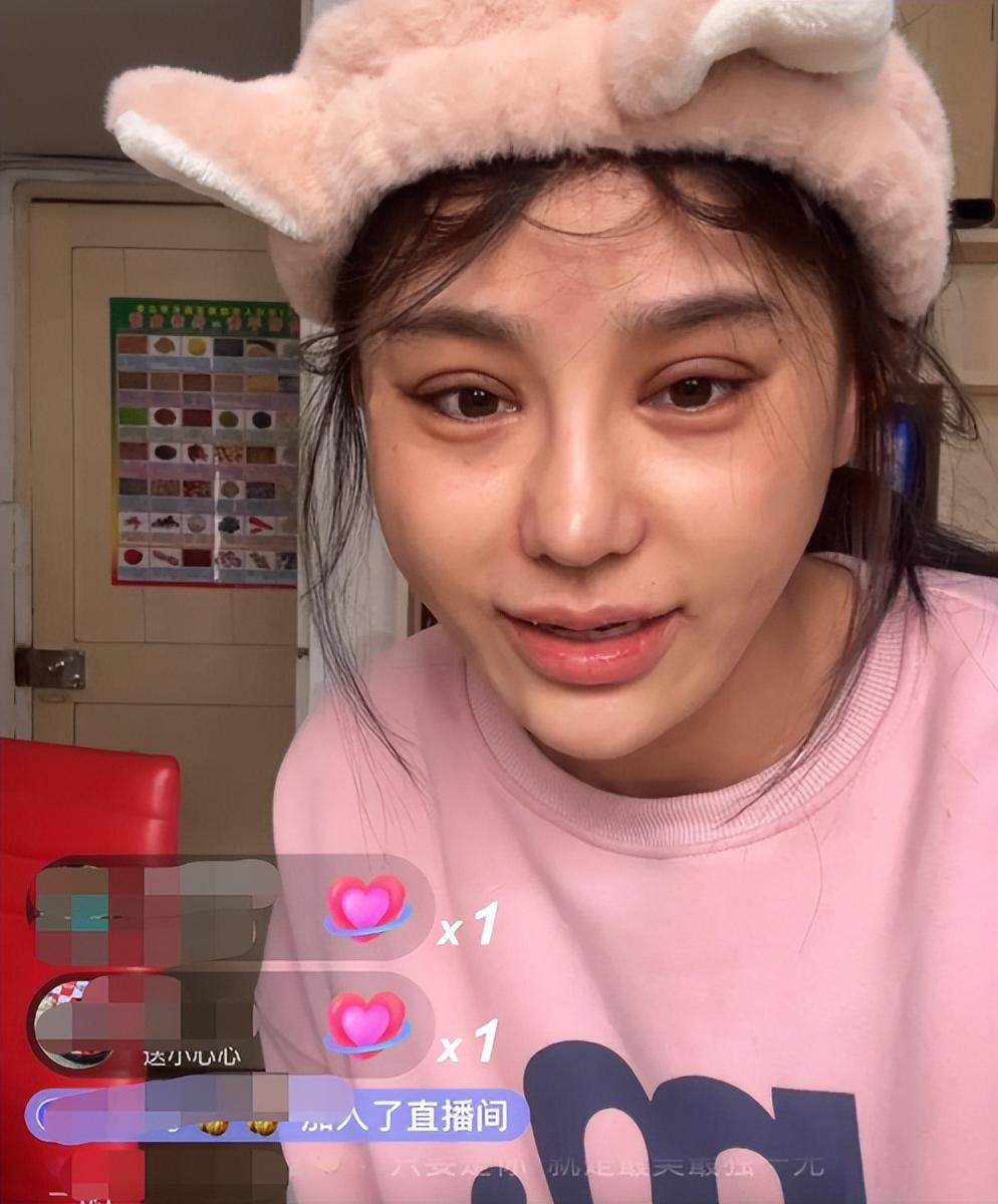 整容失败的女星蛇精脸,女星整容失败脸歪嘴斜