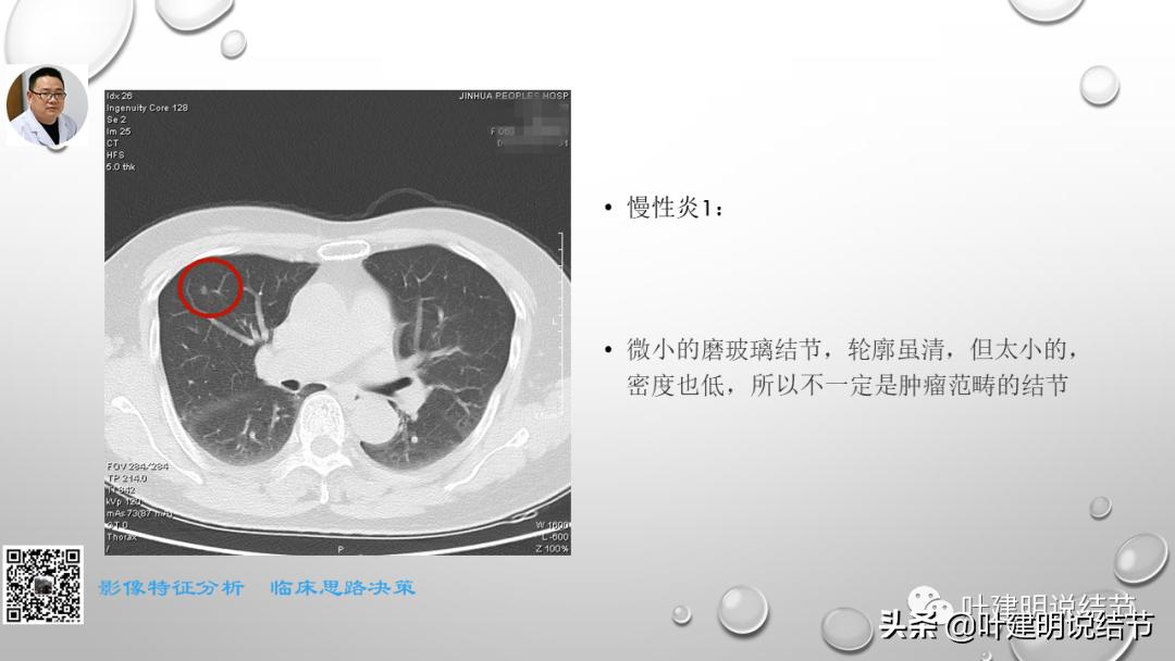 在《一脉阳光》呼吸影像诊断专题培训班上的讲课PPT（第一部分）