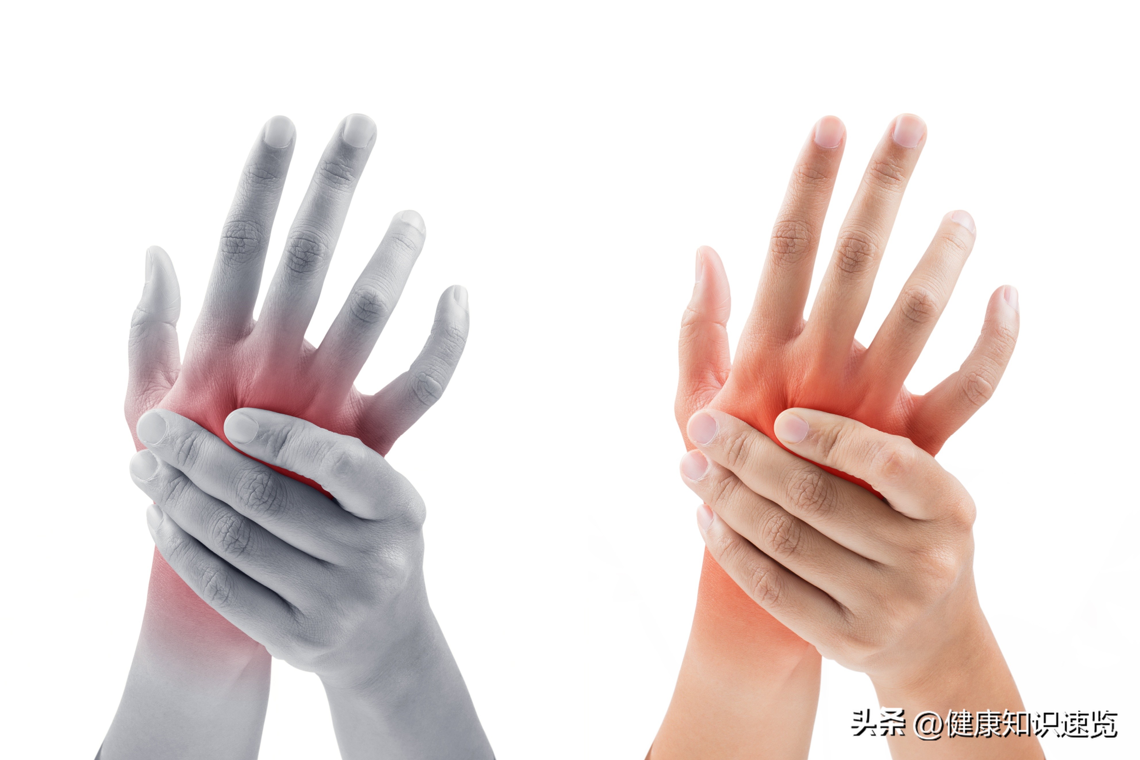 关节炎犯了应该多吃一点什么,关节炎要注意些什么