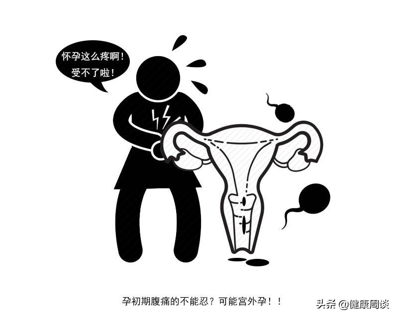 宫外孕是怎么形成的有什么表现,宫外孕都是有什么状况