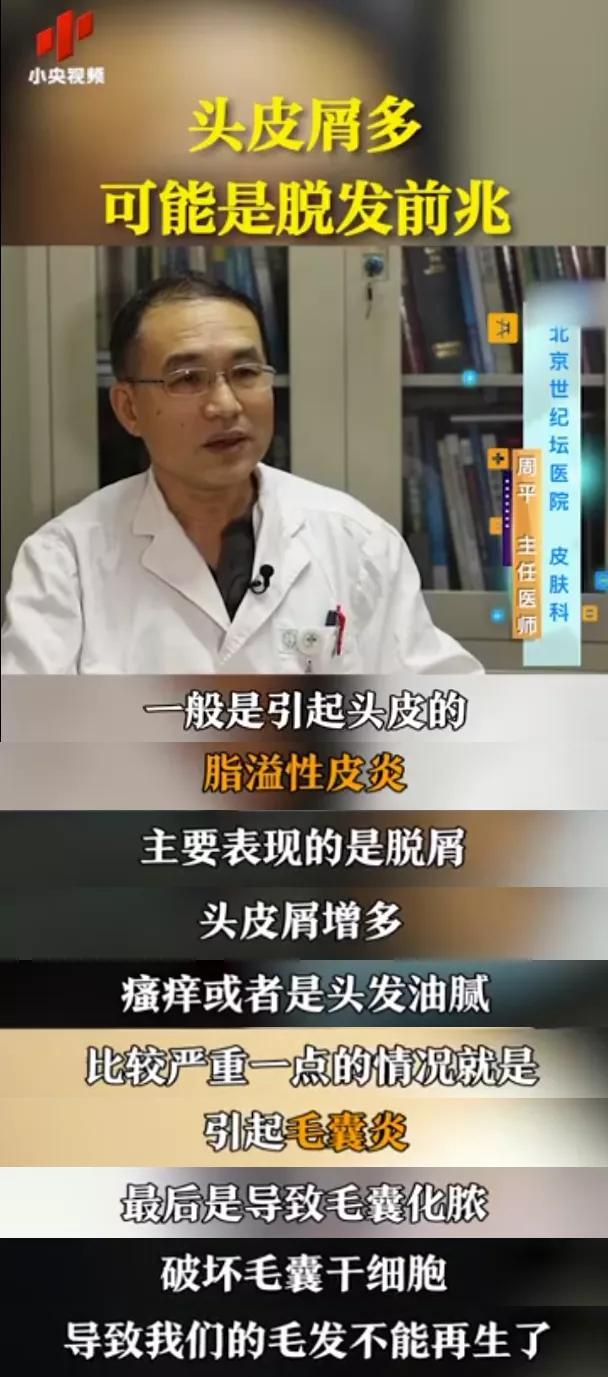 脱发跟头屑的关系,脱发和头屑的关系