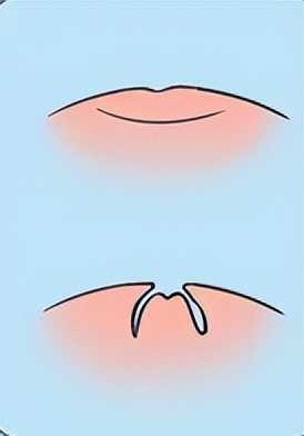 女生胸部上长了白色小点点,女生胸部长了好多小红点疙瘩