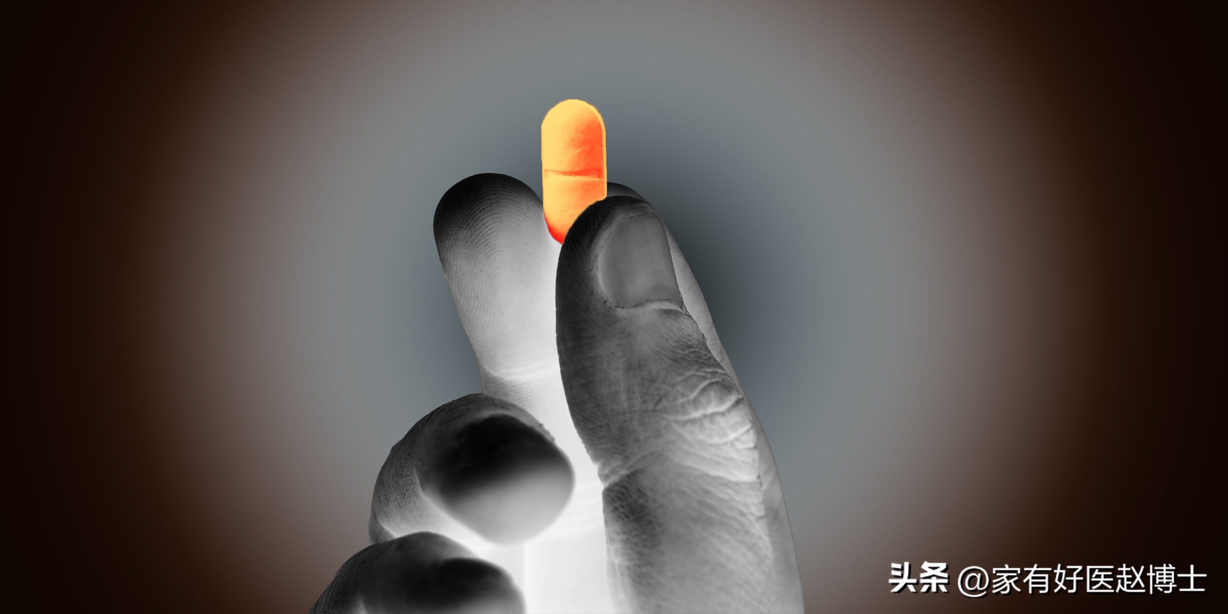 超声颈动脉可以查出什么原因,超声颈动脉斑块的危险评估