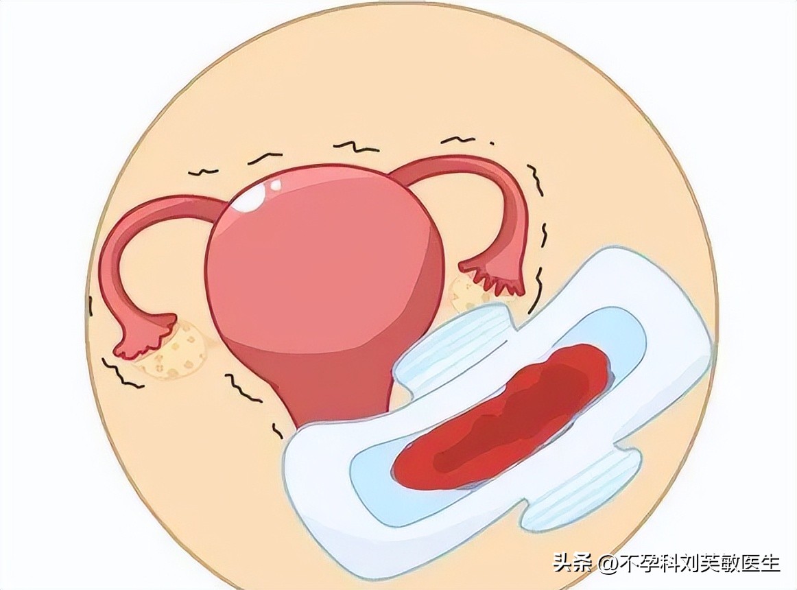 月经有血块跟痛经有关系吗,月经推迟痛经