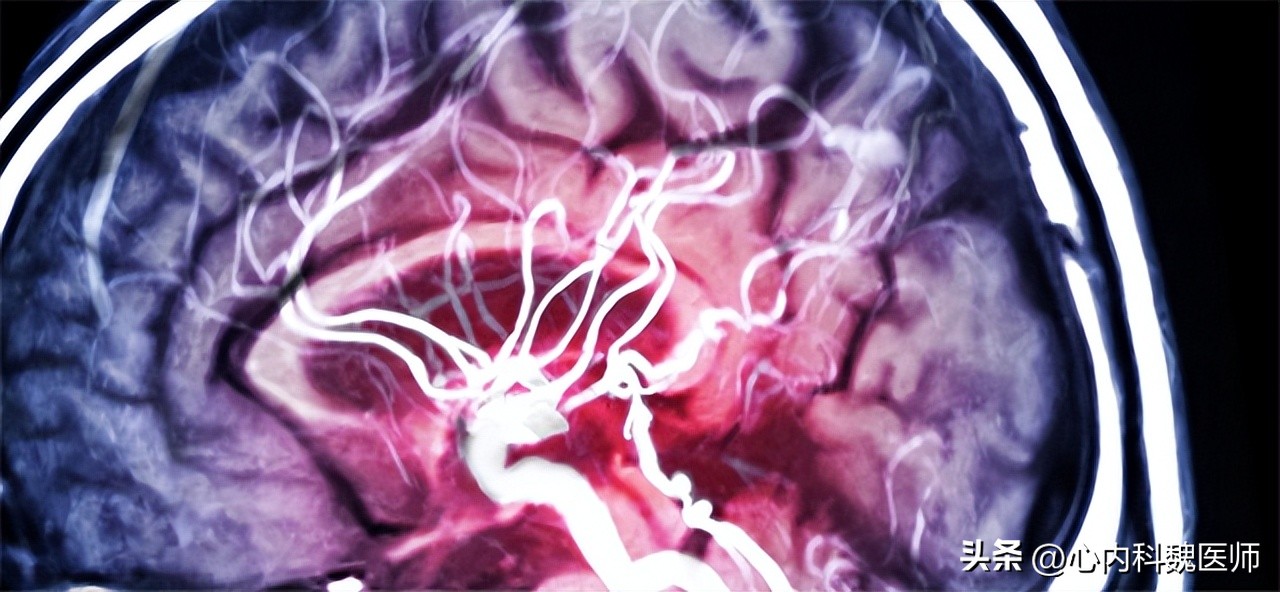 什么是磁共振检查的缺点,磁共振检查注意事项图片