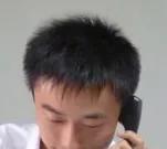 花费四万元植发一年后效果仍不明,男生大面积植发八个月真实效果