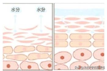 去掉眼纹会不会更显年轻,有眼纹和眼袋哪个更显老