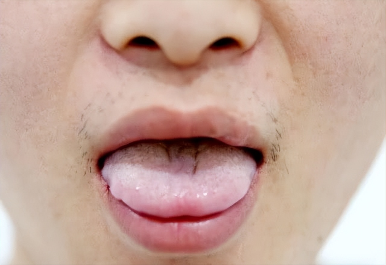 嘴里有酸臭味吃什么药,嘴里有酸甜苦咸味是怎么回事