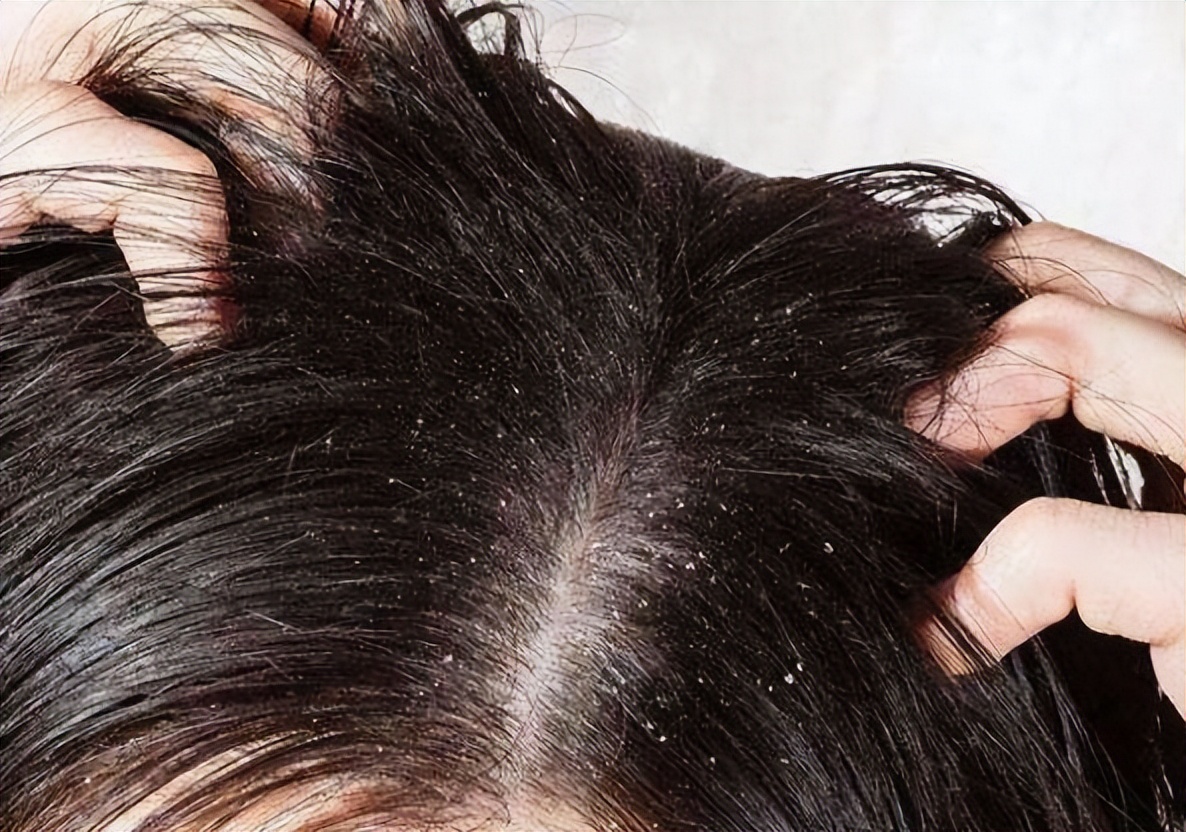 洗发水排名前十名推荐海飞丝,海飞丝洗发水红黑榜