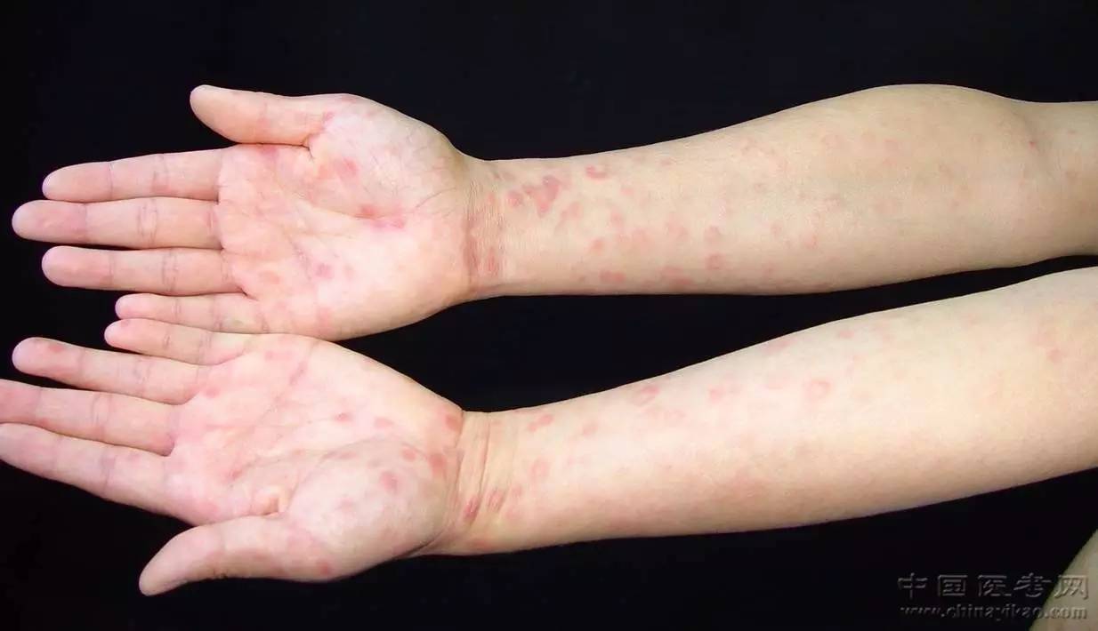 被性开放毁掉的年轻人！拿生命发生的关系，只有一次也能摧毁你