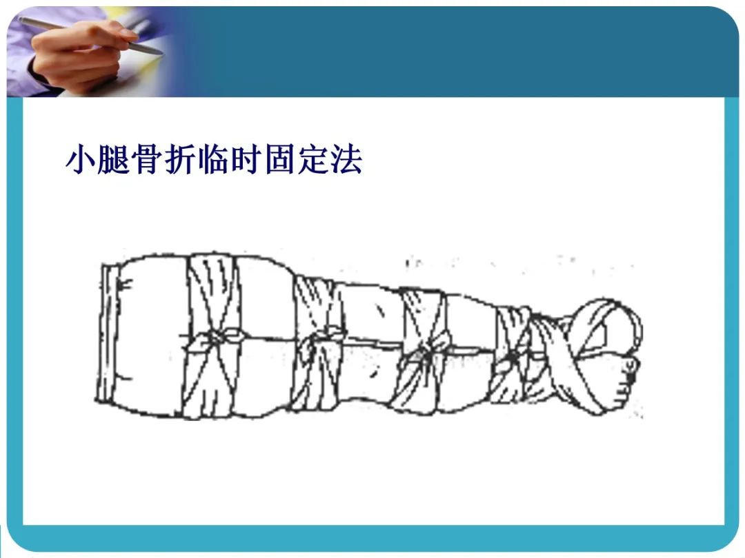 创伤后应激障碍ppt课件,创伤ppt课件