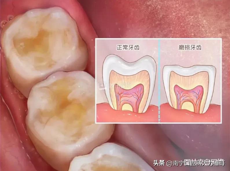 做好这5点远离胃病,做好这五件事避免口腔癌找上门