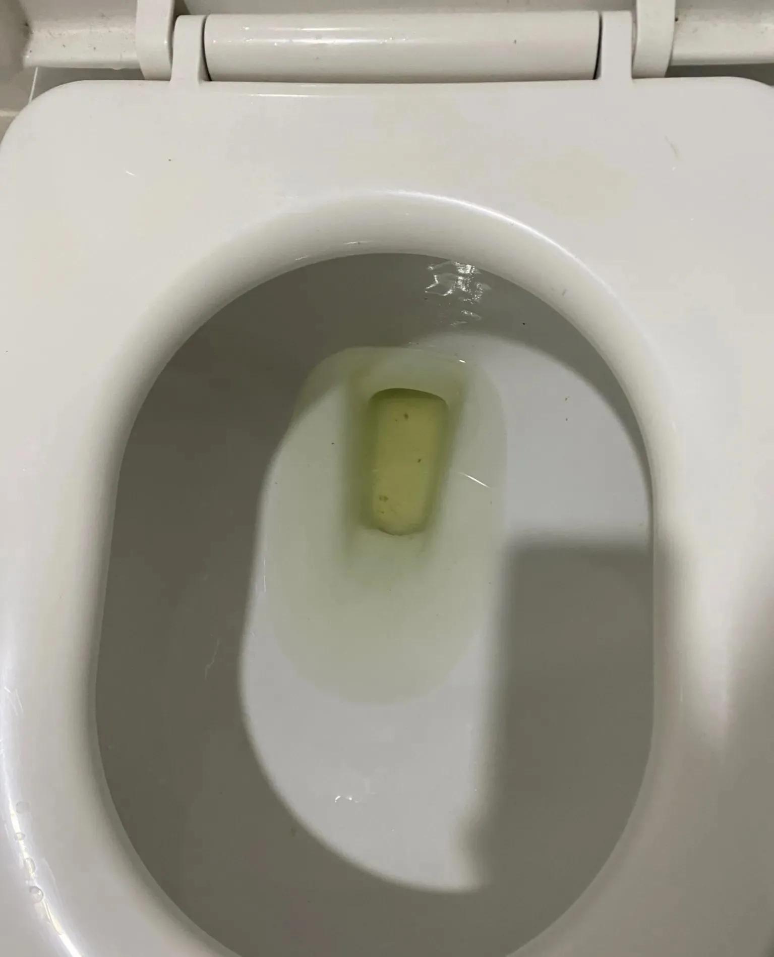 子宫肌瘤开腹手术后要卧床多久,子宫肌瘤开腹手术后敷料贴多久