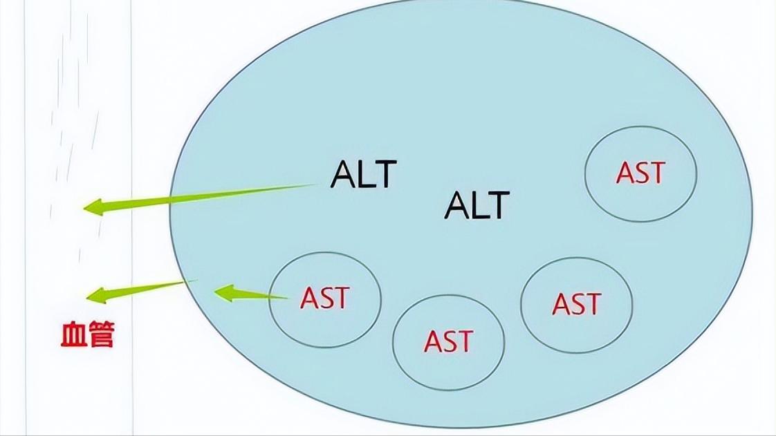 肝癌谷丙转氨酶和谷草转氨酶800多,谷丙转氨酶高多少可以断定为肝癌