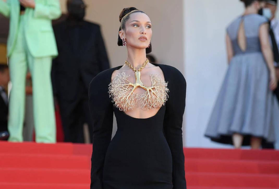 贝拉哈迪德遗传病,贝拉哈迪德莱姆病