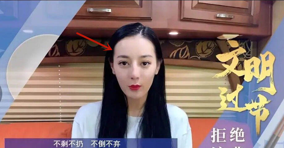 盘点女明星发际线危机,女明星秃头前后对比