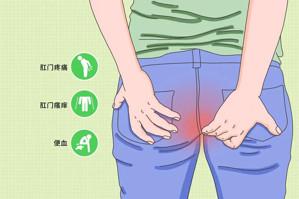 肛门潮湿痒有分泌物怎么治疗,肛门潮湿瘙痒有异味怎么治疗