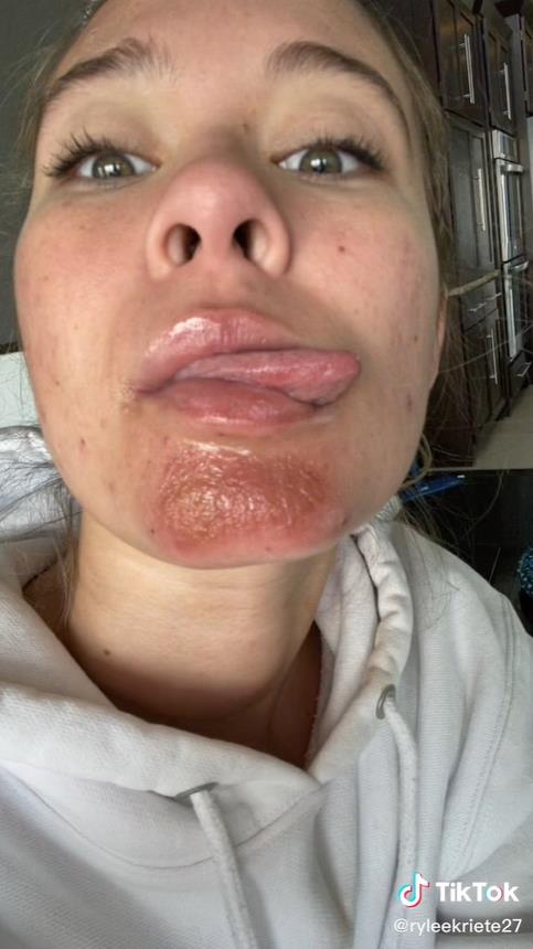 澳洲妹子和男友接吻,澳大利亚女子与男友接吻