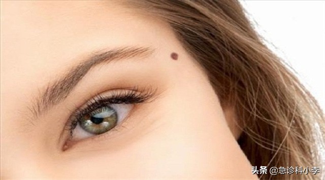 身上出现不痒的小红点是怎么回事,身上突然起了很多小红点不痛不痒