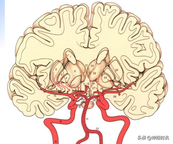 脑受撞击少量出血症状表现,脑动脉瘤出血的表现
