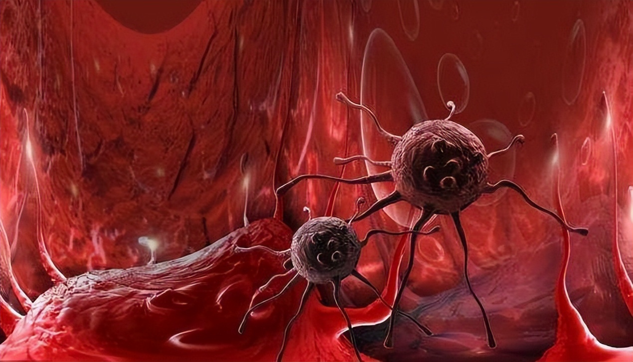 癌症一旦有症状是不是已经晚期了,癌症并不是真正意义上的疾病