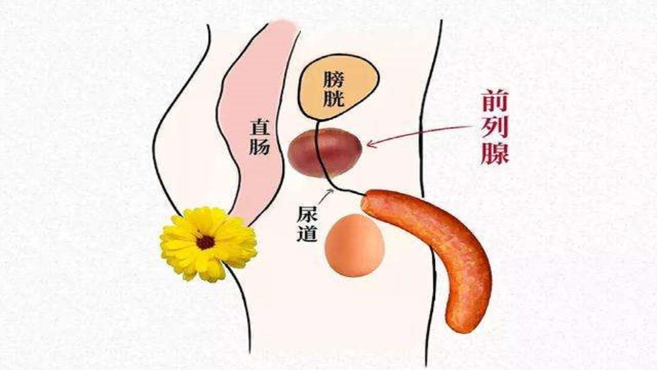 怎样有效预防前列腺癌发生,正确生活方式有助预防前列腺癌