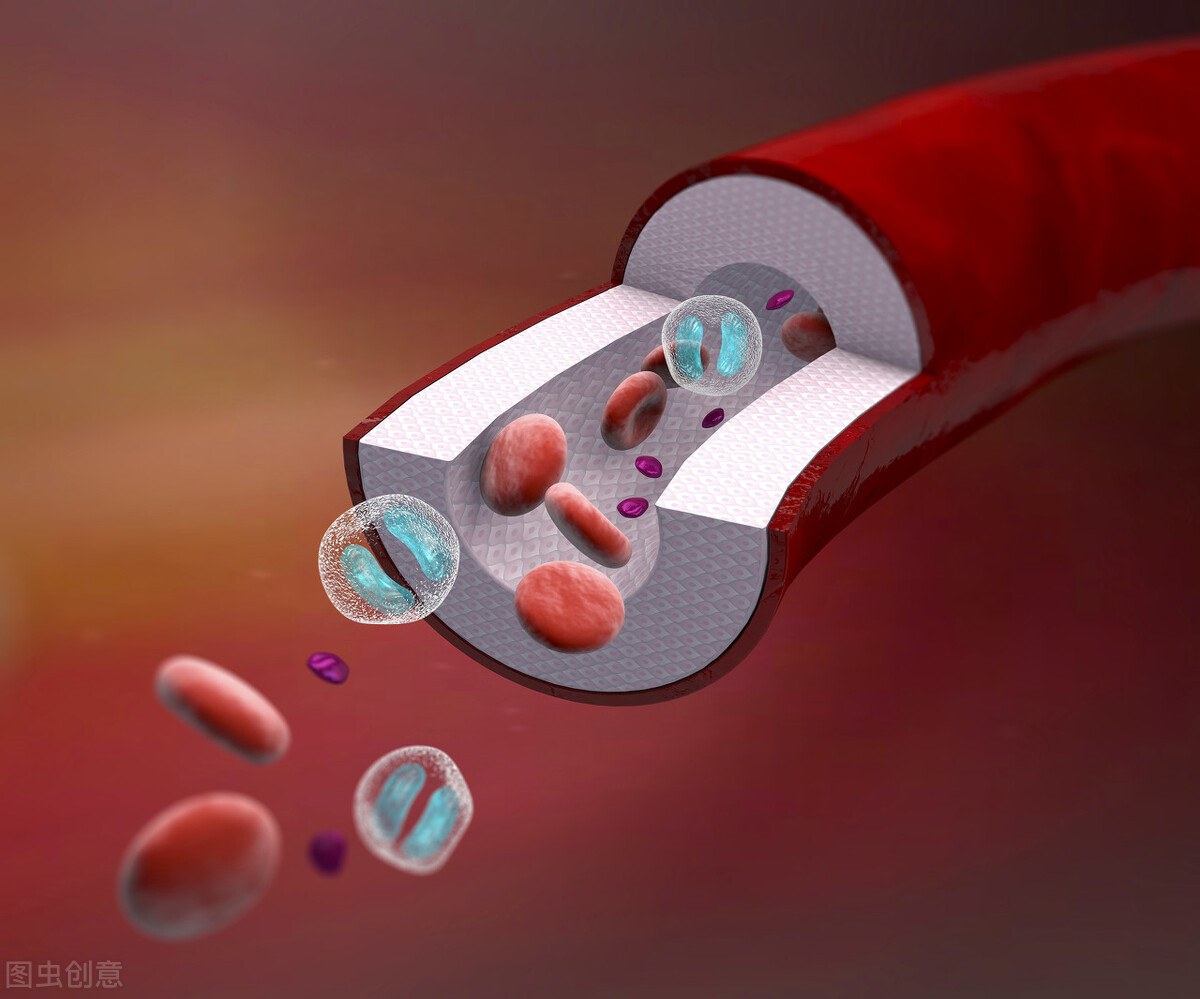 一张治脑梗后遗症的方子,化瘀血、清痰热,化解不能动、语言不清