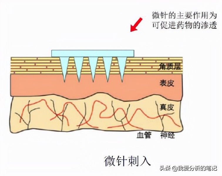 当微针和化妆品结合，你将变得更美。哪些公司有机会？