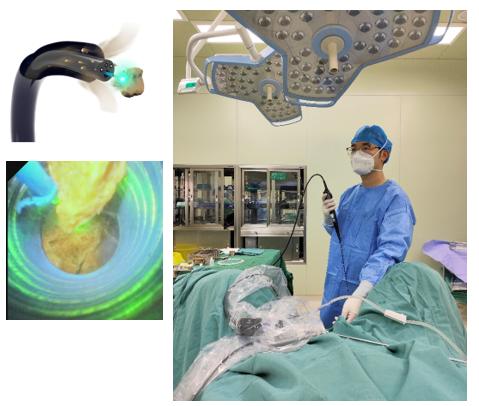 无创纳米手术,结石手术无创是怎样的