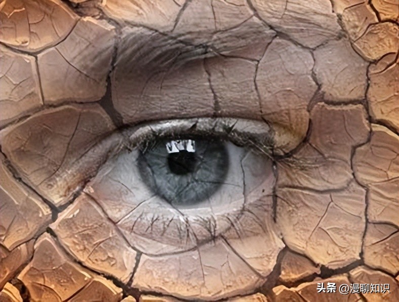 干眼病属于眼底病吗,干眼症状是怎么得来的