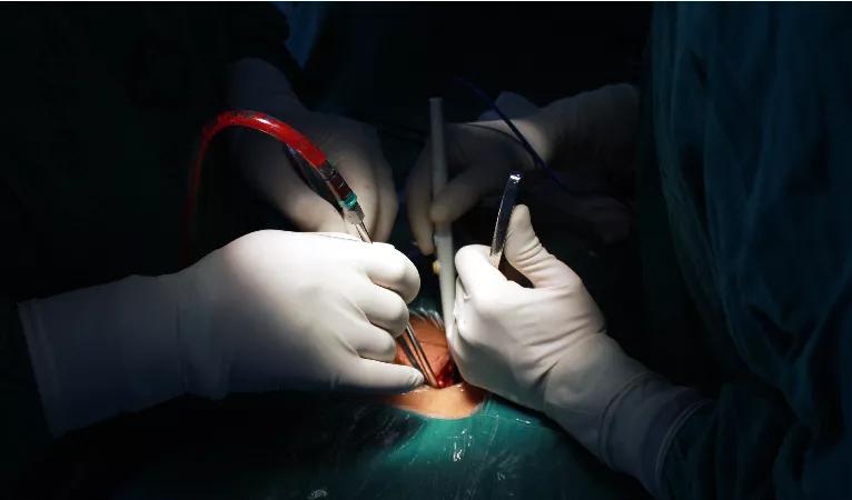 疼痛科最新视频,疼痛科最新技术进展