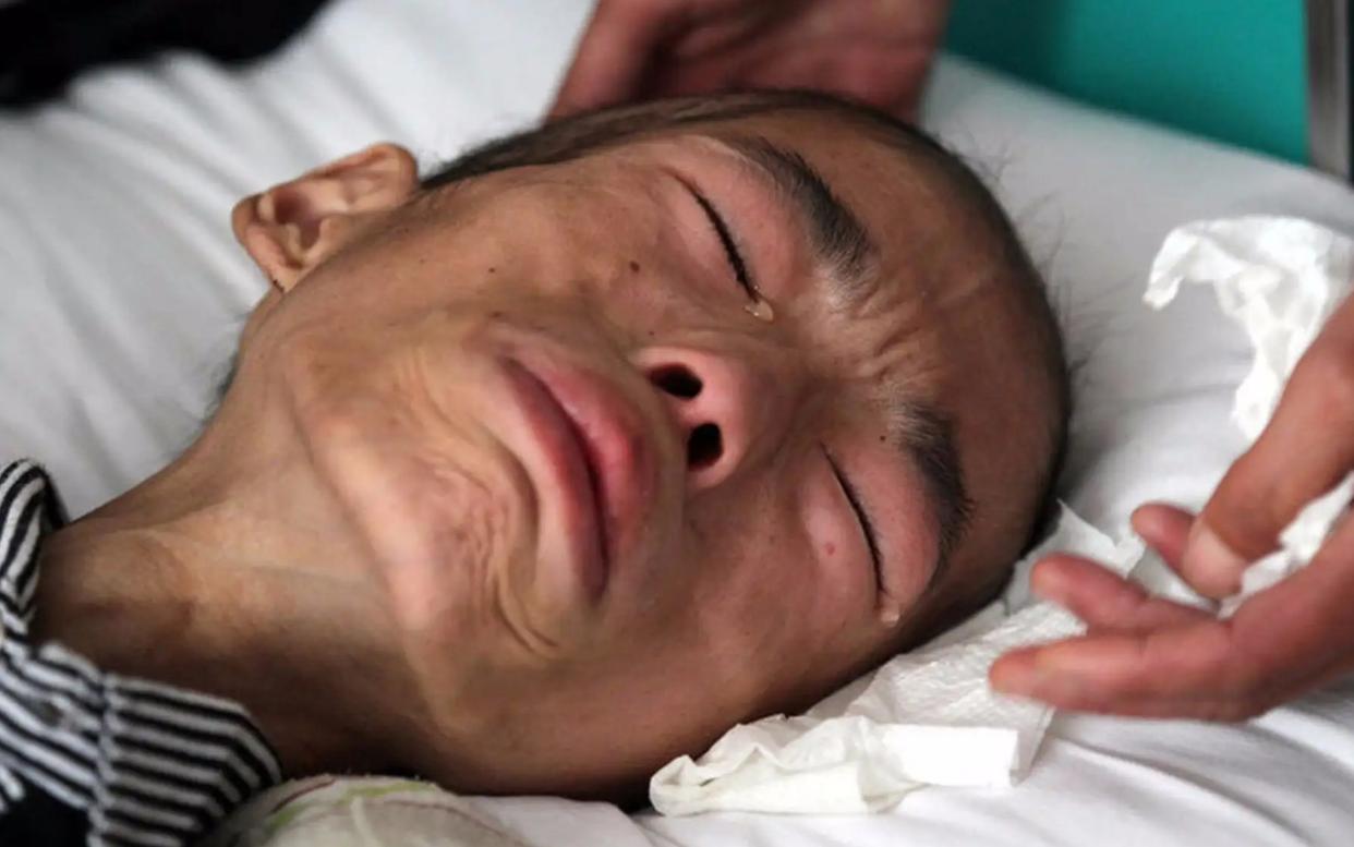 癌细胞害怕5种维生素,癌细胞怕有氧环境还是无氧环境啊