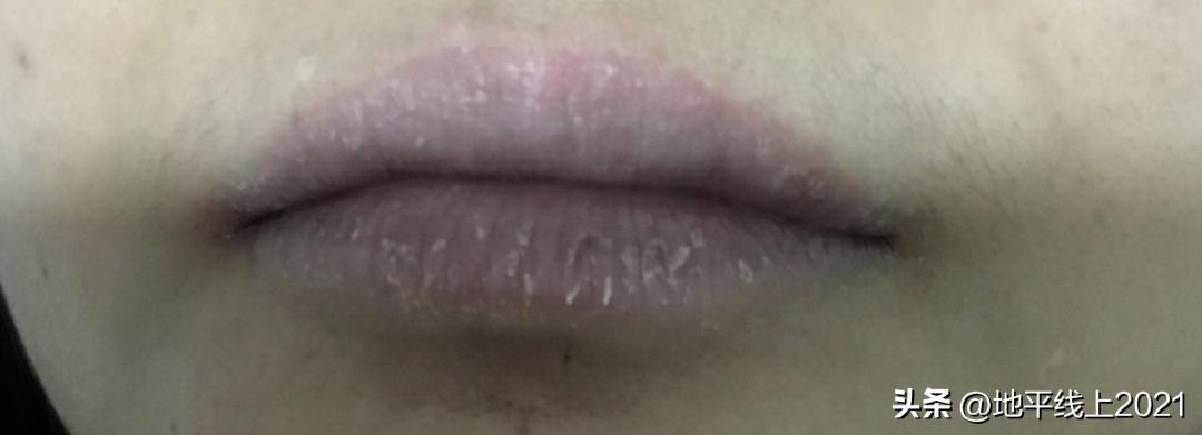 唇色深怎么办怎么变淡,唇色深怎么办四大技巧改善唇色深