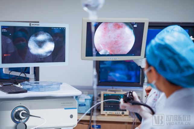 连拿3张医疗器械注册证,精微视达何以领跑国产共聚焦显微内窥镜？