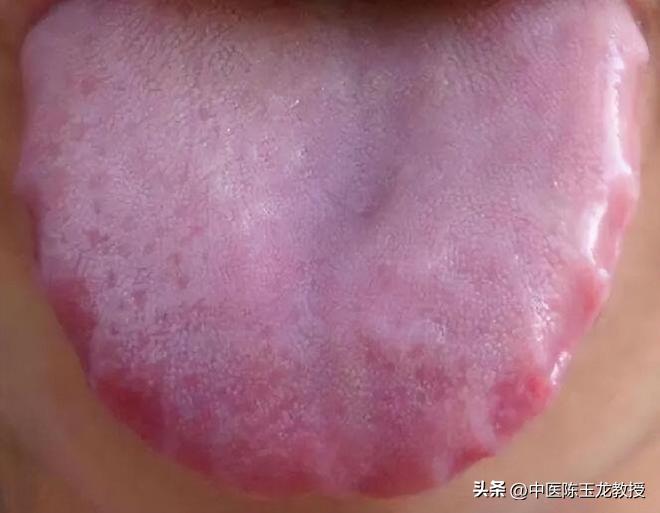 腹部凸出瘦肚子,腹部脂肪减1毫米