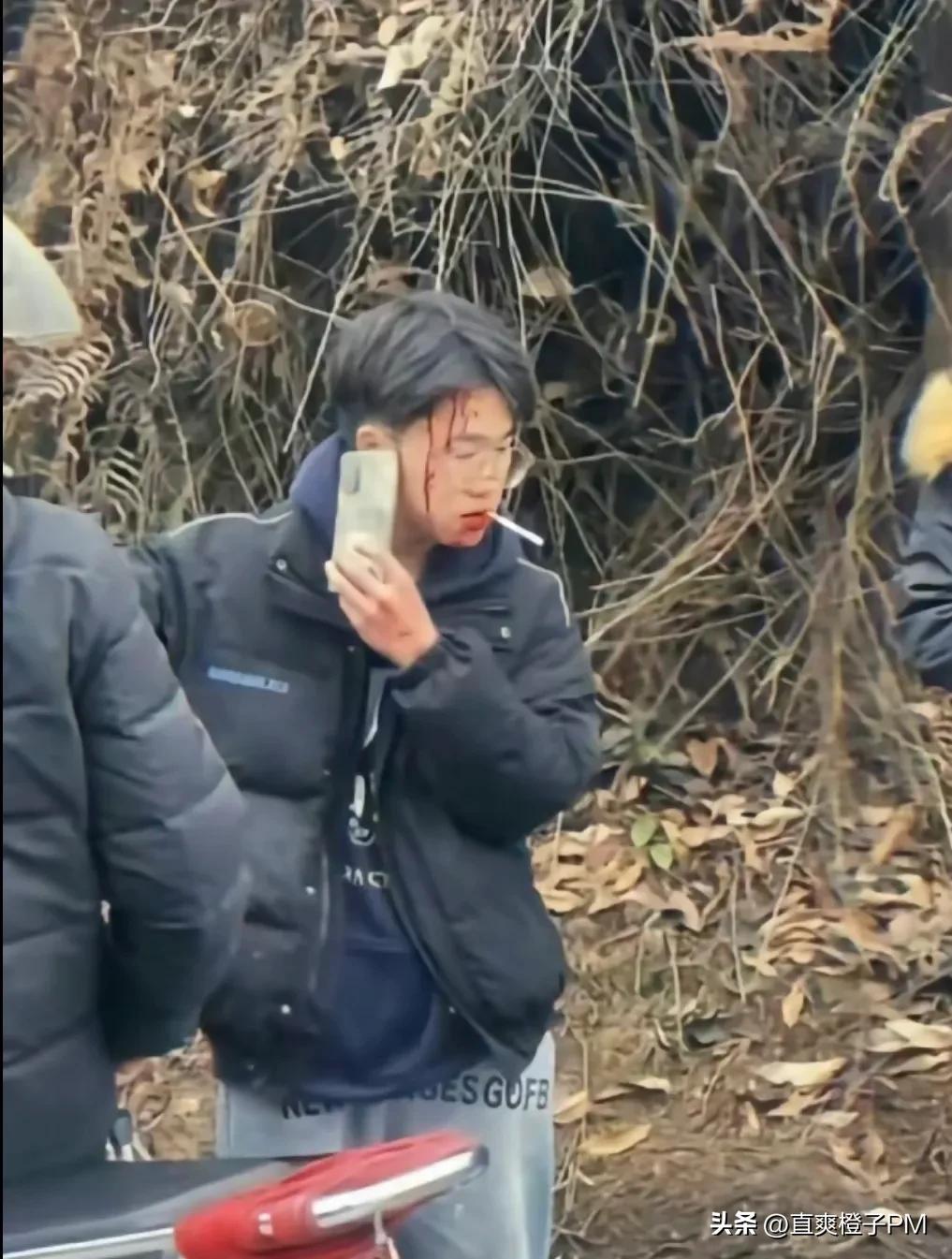 被车子撞了什么感觉,之前被车撞的内伤现在又痛了