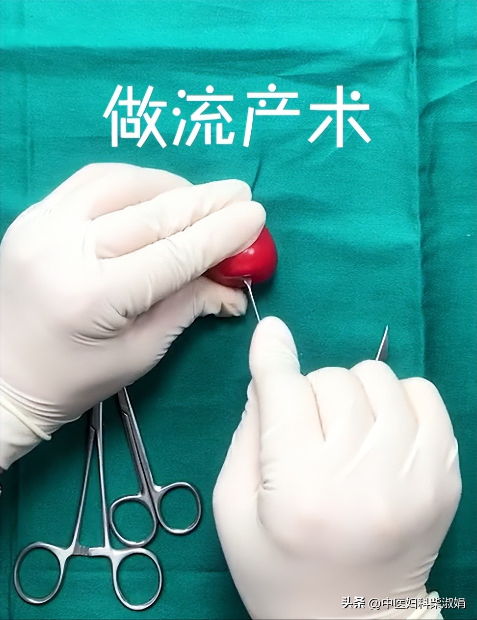 一组图，揭秘人流后的子宫状态，结果太直观了