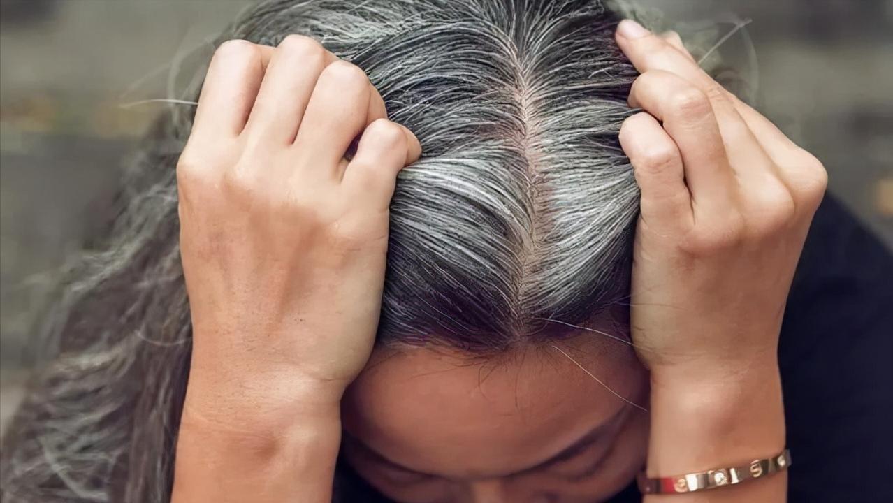 年轻女性突然白发增多是什么原因,中年女性有白发怎么调理