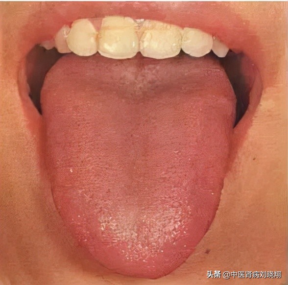 刘主任让病人伸舌头，看的是什么？