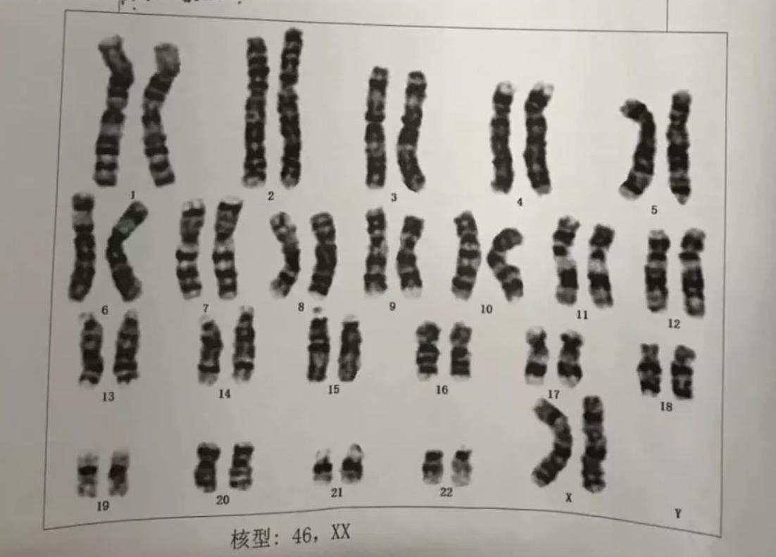 阴阳人有没有存在,阴阳人存在么
